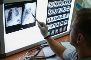 Doctor diagnosing COPD of patient with industrial disease symptoms